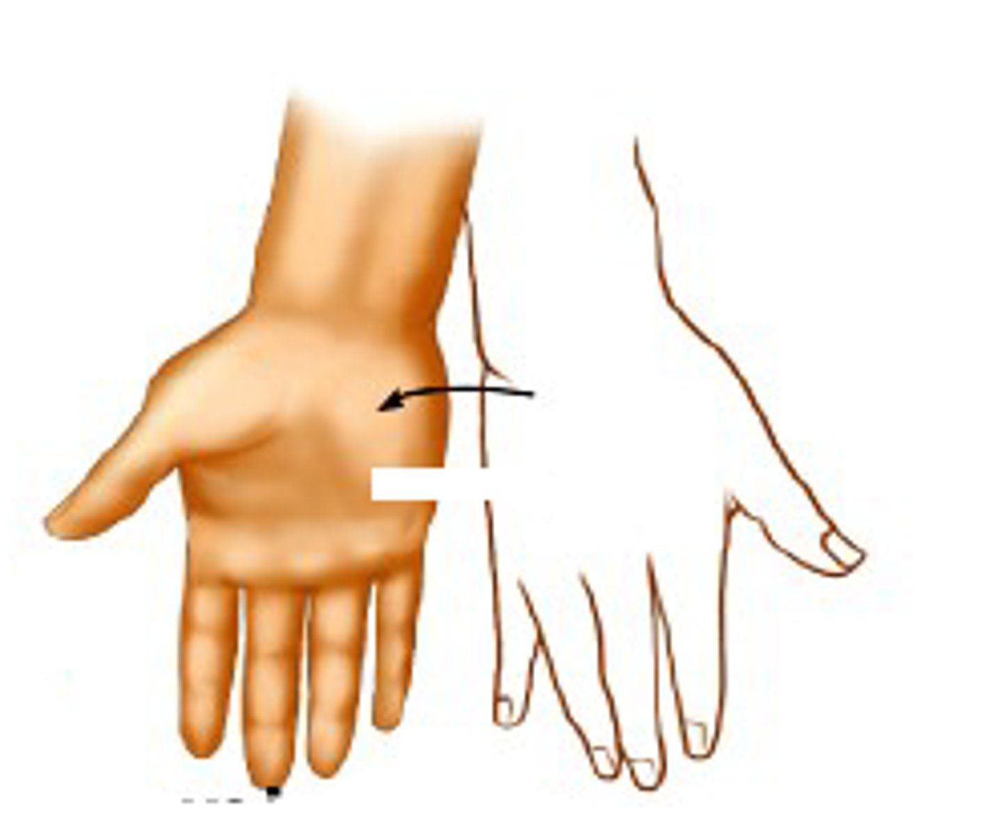 <p>Supination (holding soup)</p>