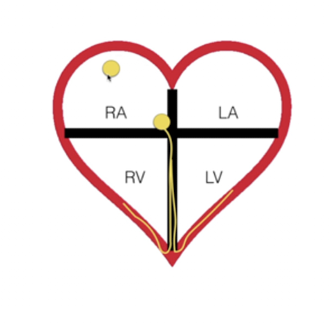 <p>Electrical Activity of the Heart:</p><ul><li><p>Describe:</p><ul><li><p>Sinoatrial Node (SA Node): </p></li><li><p>Atrioventricular Node (AV Node):</p></li><li><p>Bundle Branches: </p></li><li><p>Purkinje Fibers:</p><p></p></li></ul></li></ul><p></p>
