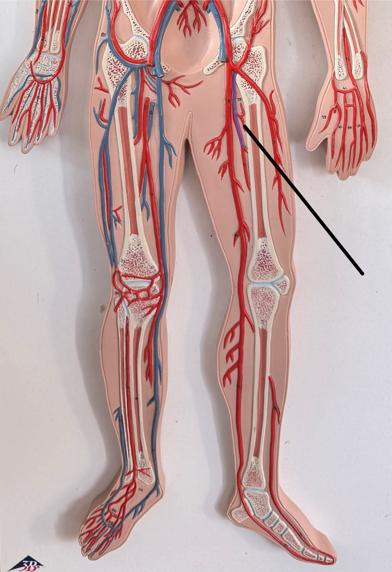 <p>Name this artery.</p>