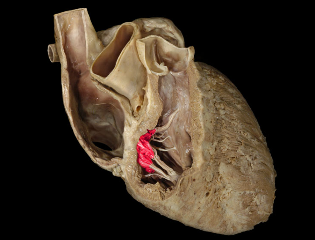 term image
