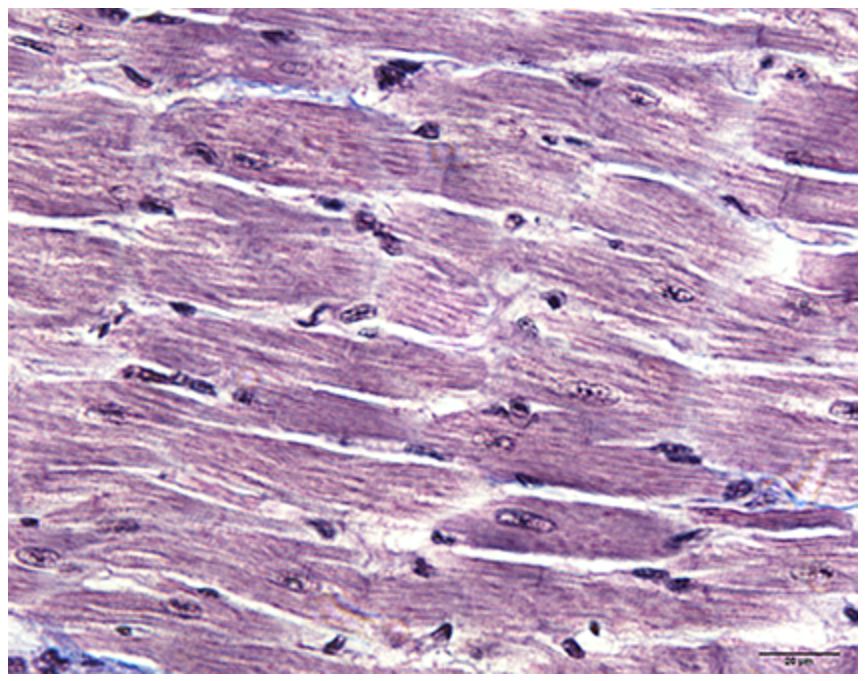 <p>What muscle is this?</p>