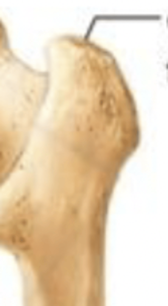 <p>greater trochanter</p>