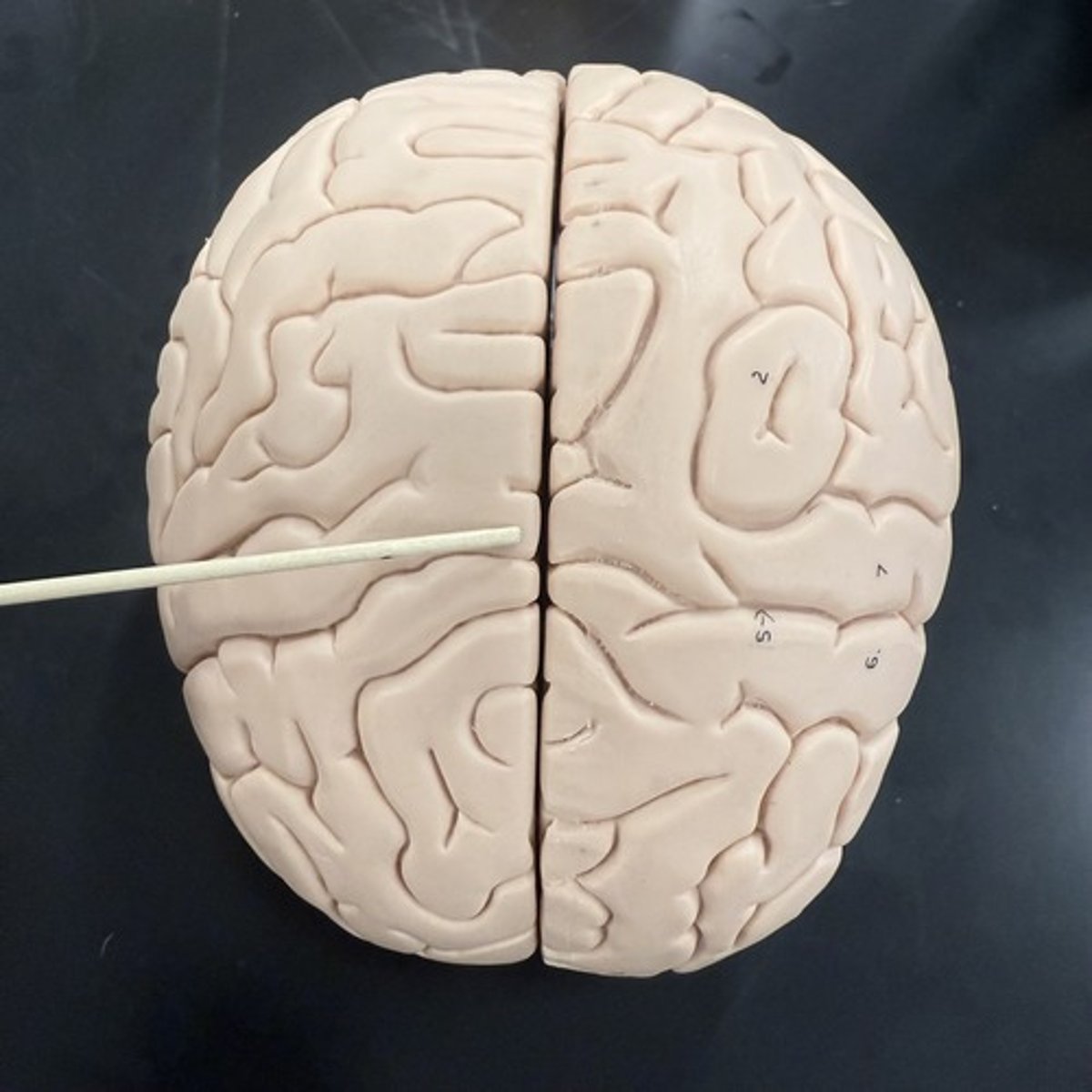 <p>What is this deep groove?</p>