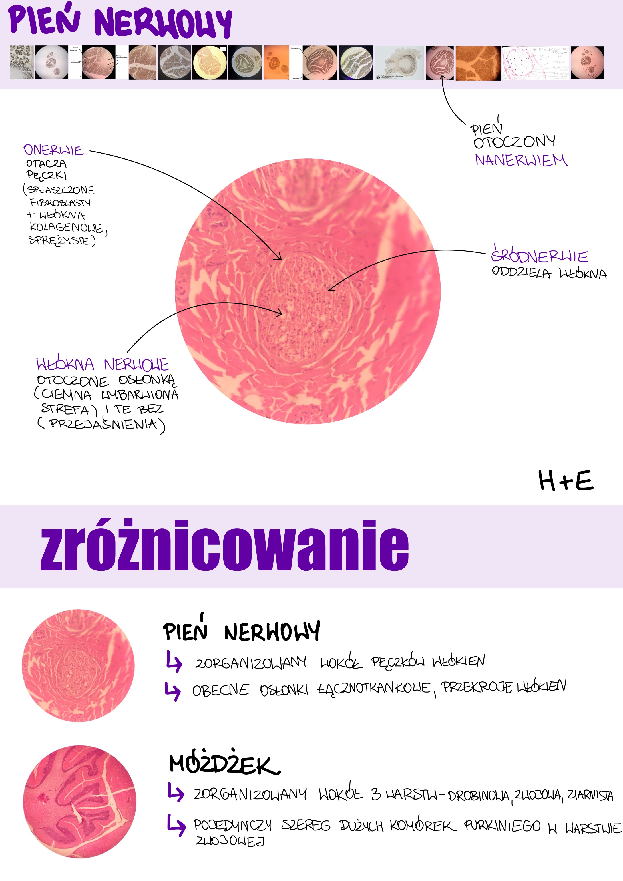 <p>Pień nerwowy</p>