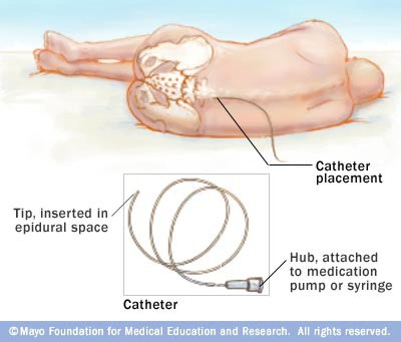 <p>it can be adjusted and extended if needed</p>