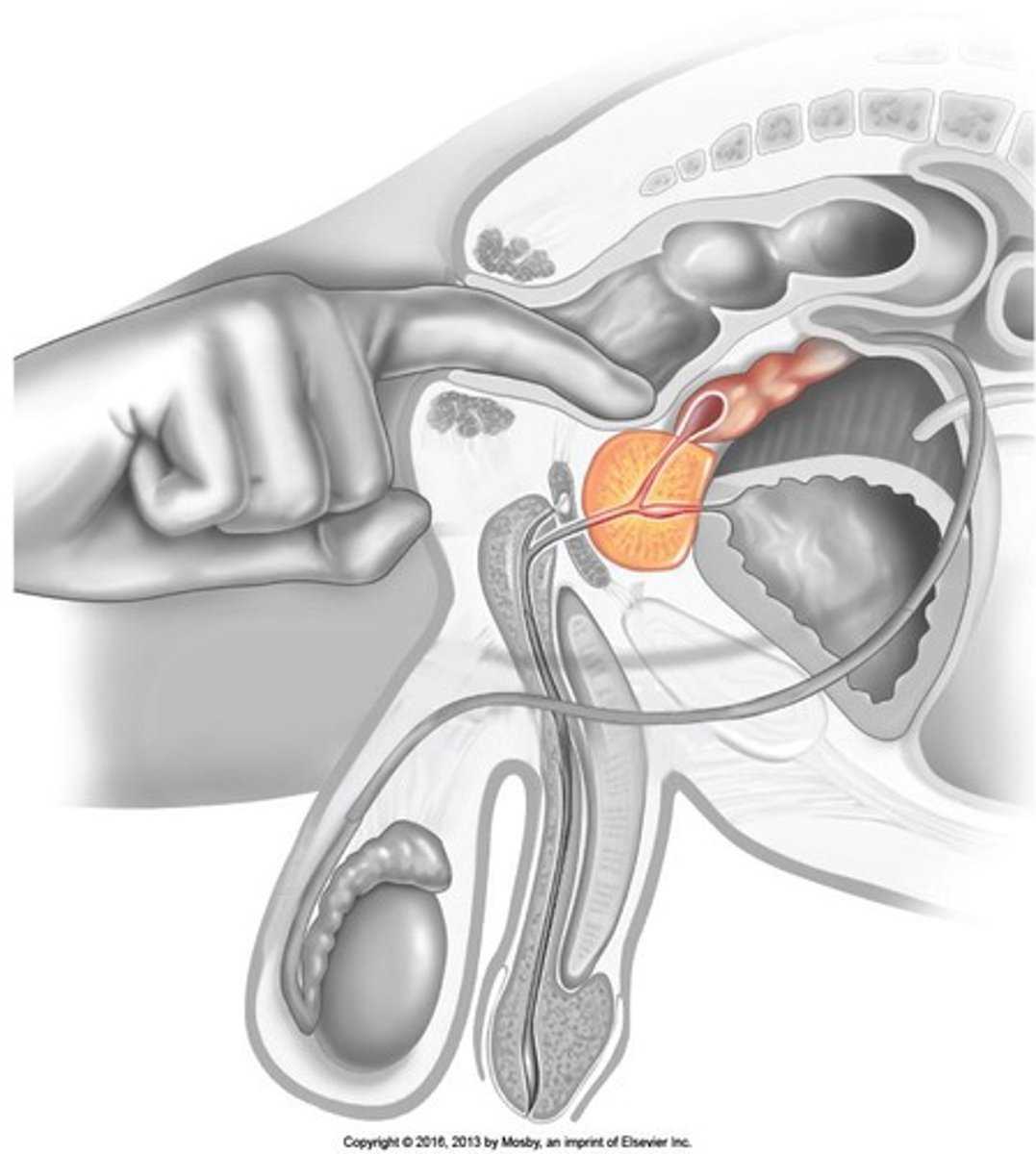 <p>Vascular spaces fill with blood, causing the penis to enlarge and become rigid.</p>