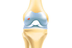 <p>Hyaline cartilage covering epiphyses where bones articulate, reducing friction.</p>