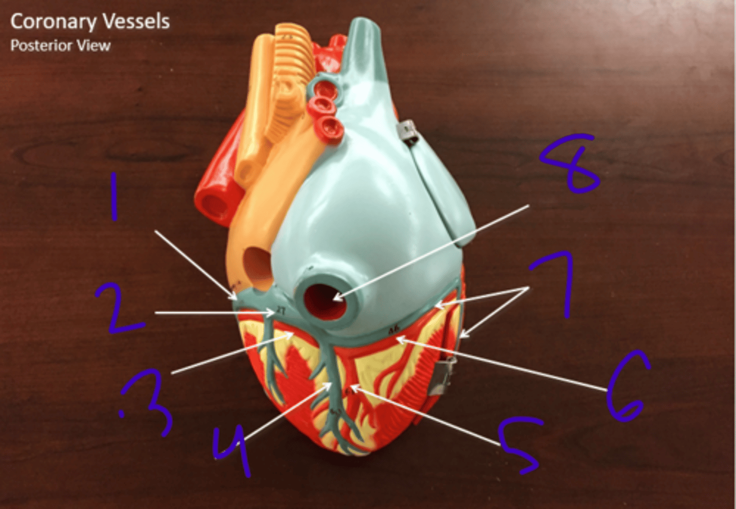 <p>coronary vessels (posterior view) - #1</p>