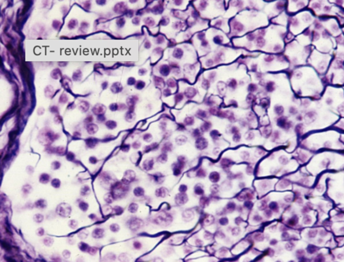<p>What connective tissue type is shown in this image?</p>