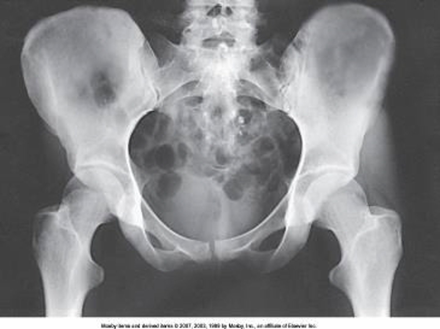 <p>What positioning error is evident in the image below?</p>