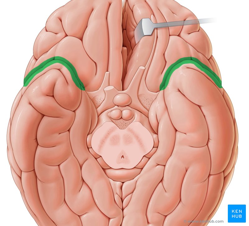 <p>Name the fissure</p>
