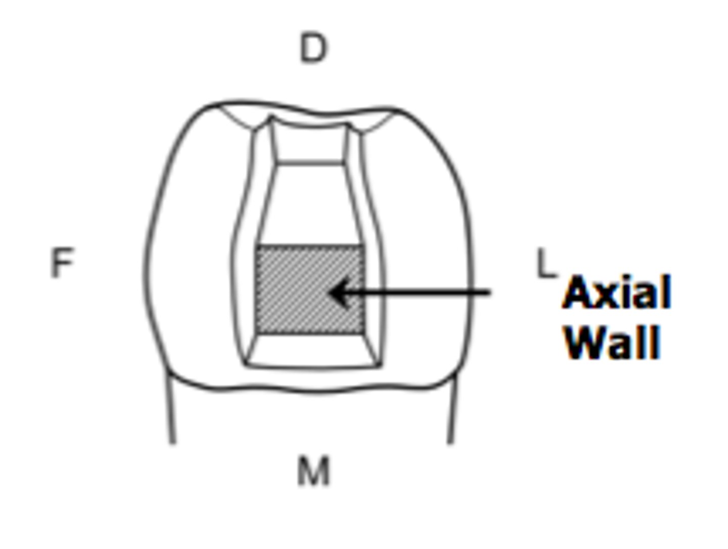 <p>parallels long axis of tooth, vertical plane of the tooth adjacent to pulp</p>