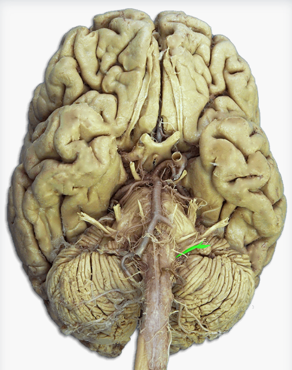 <p>Label this cranial nerve</p>