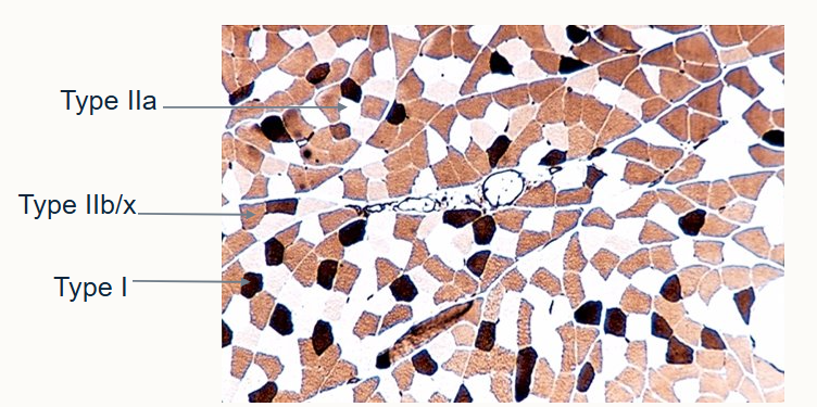 <p>Type IIa - white</p><p>Type IIb/x - brown, grainy</p><p>Type I - black</p>