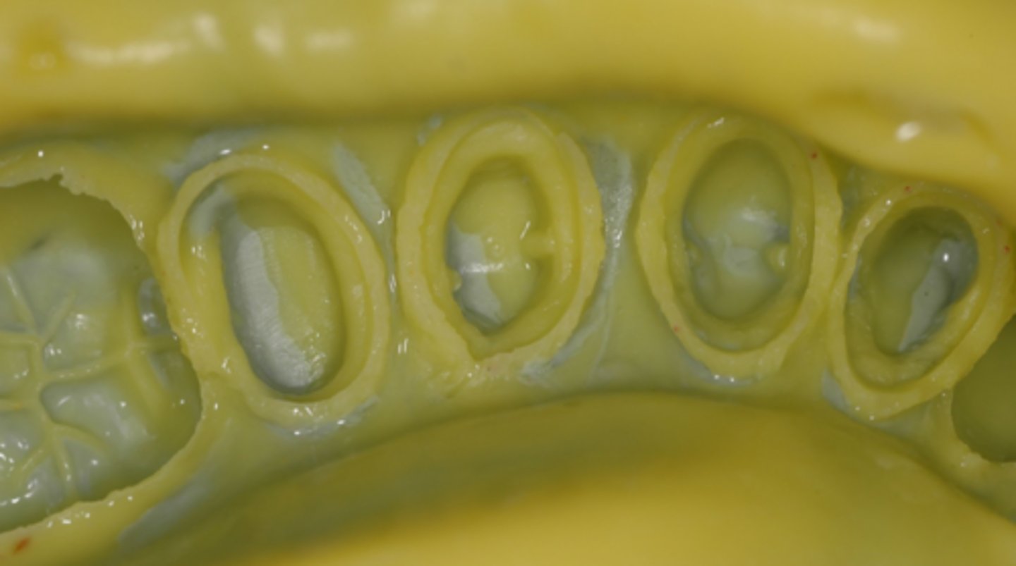 <p>What two things are you looking for here in the impression?</p>