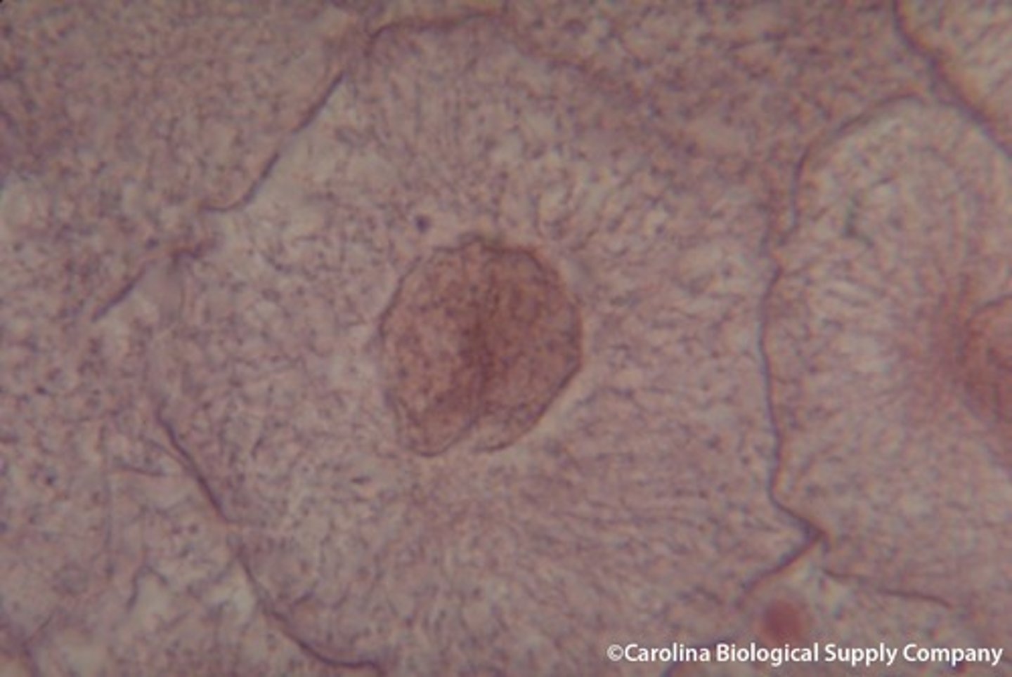 <p>Individual chromosomes are not distinguished</p>