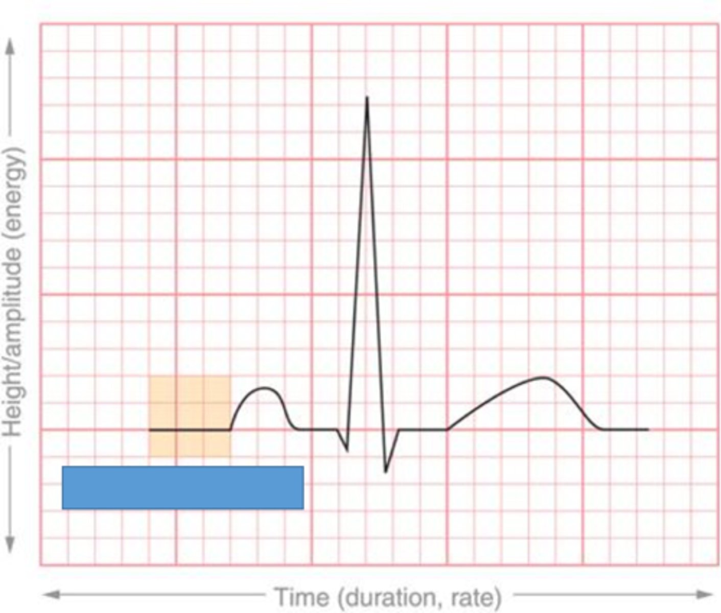 <p>The baseline of the ECG</p>