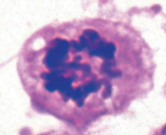 <p>which stage of mitosis is shown here&nbsp;</p>