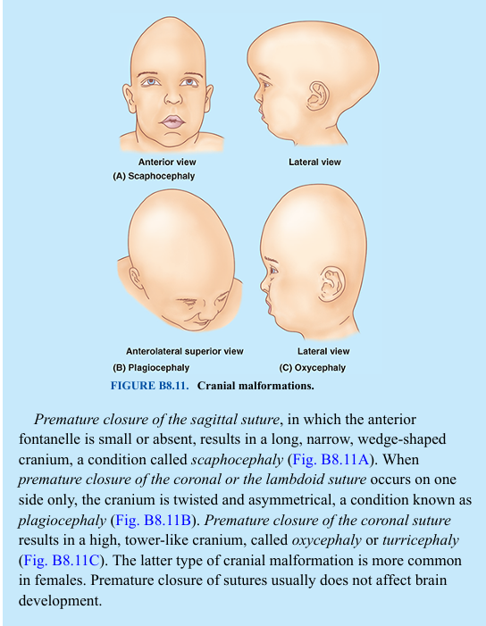 <p>Premature closure of the cranial sutures (primary craniosynostosis) results in several cranial malformations (Fig. B8.11). The incidence of primary craniosynostosis is approximately 1 per 2,000 births (Kliegman et al., 2020). The cause of craniosynostosis is unknown, but genetic factors appear to be important. The prevailing hypothesis is that abnormal development of the cranial base creates exaggerated forces on the dura mater (outer covering membrane of the brain) that disrupt normal cranial sutural development. These malformations are more common in males than in females and are often associated with other skeletal anomalies. The type of malformed cranium that forms depends on which sutures close prematurely.</p><p>Premature closure of the sagittal suture, in which the anterior fontanelle is small or absent, results in a long, narrow, wedge-shaped cranium, a condition called scaphocephaly (Fig. B8.11A). When premature closure of the coronal or the lambdoid suture occurs on one side only, the cranium is twisted and asymmetrical, a condition known as plagiocephaly (Fig. B8.11B). Premature closure of the coronal suture results in a high, tower-like cranium, called oxycephaly or turricephaly (Fig. B8.11C). The latter type of cranial malformation is more common in females. Premature closure of sutures usually does not affect brain development.</p>