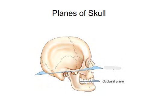 <p>Occlusal Plane </p>