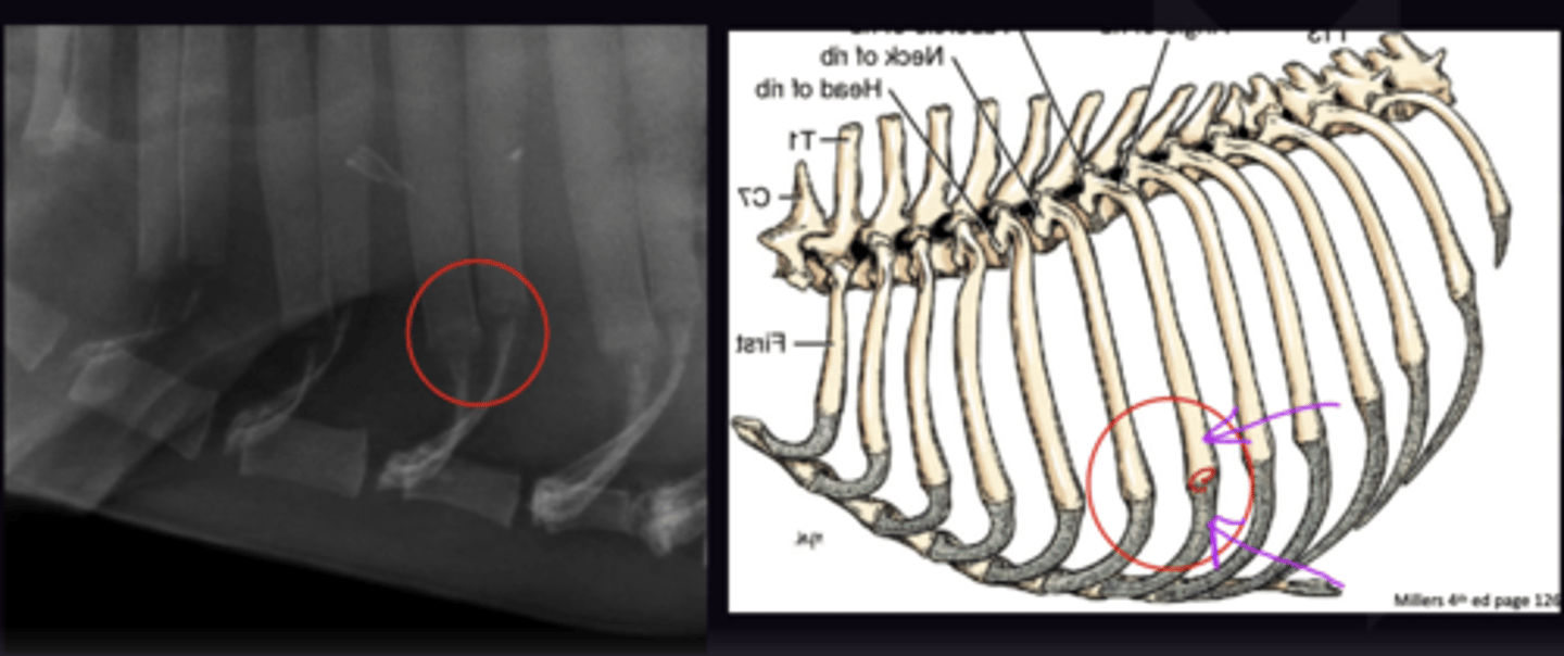 <p>1. Legs are pulled Cranially, not superimposed on thorax</p><p>2. - Level Sternum</p><p>- Costochondral Junctions are same level (Not necessarily superimposed)</p>