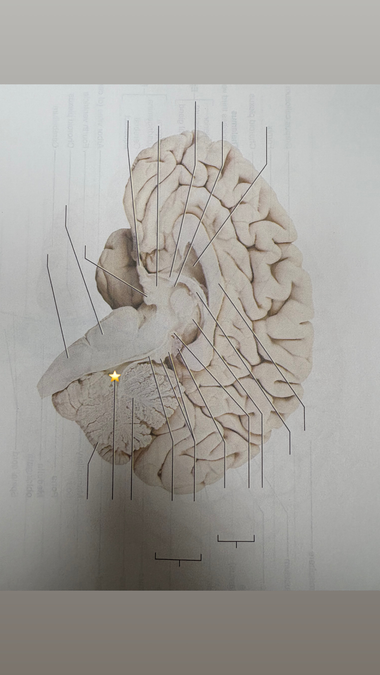 <p>name the starred structure</p>