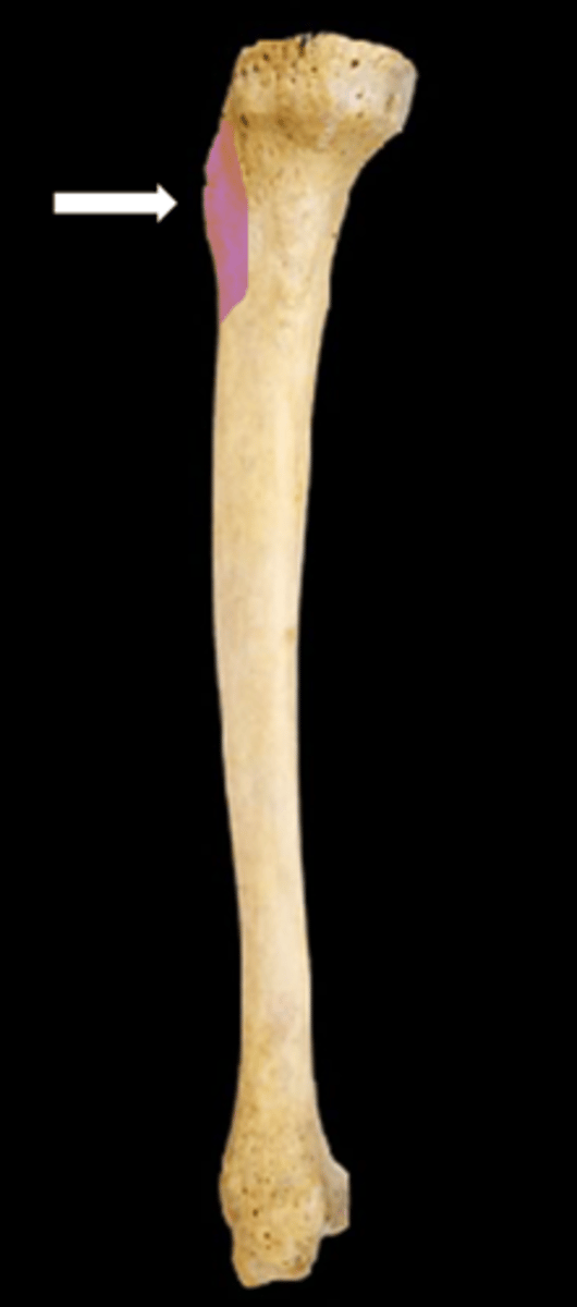 <p>name the part</p>