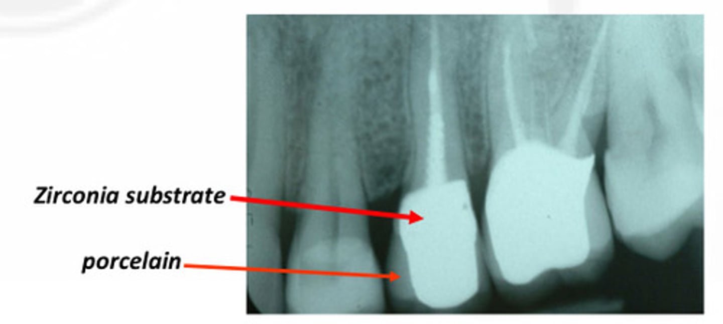 <p>PFM have Similar radiographic appearance to__</p>