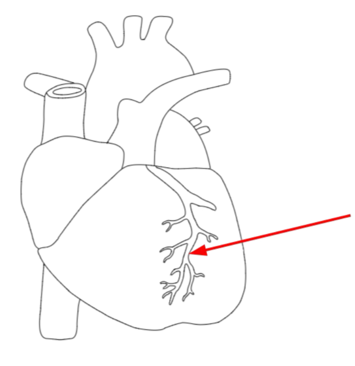 <p>It is pulmonary artery and it supplies heart muscle with blood</p>