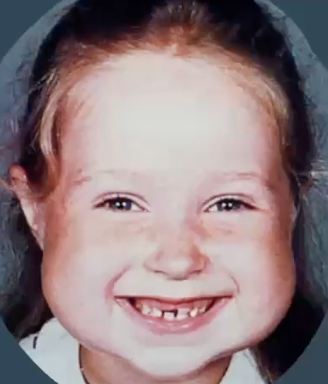 <p><strong>PAINLESS bilateral</strong> posterior mandible <strong>ENLARGEMENT</strong> in <strong>children</strong> </p>