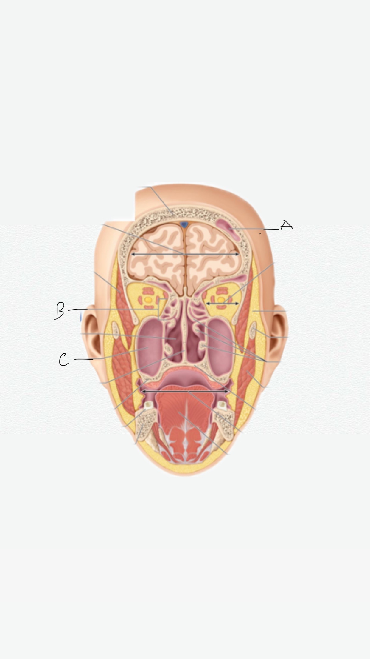 <p>C</p>