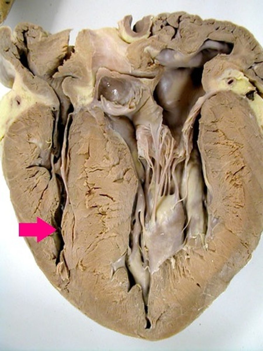 <p>Identify the chamber.</p><p>Thick-walled chamber adjacent to the left ventricle.</p>