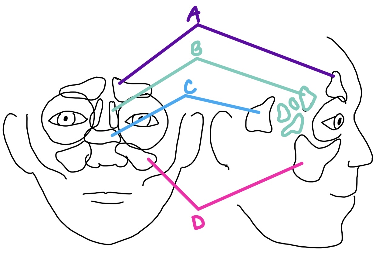 <p>sinus with several air cells on both sides of perpendicular plate of ethmoid bone, medial to the orbits</p><p><strong>B</strong></p>