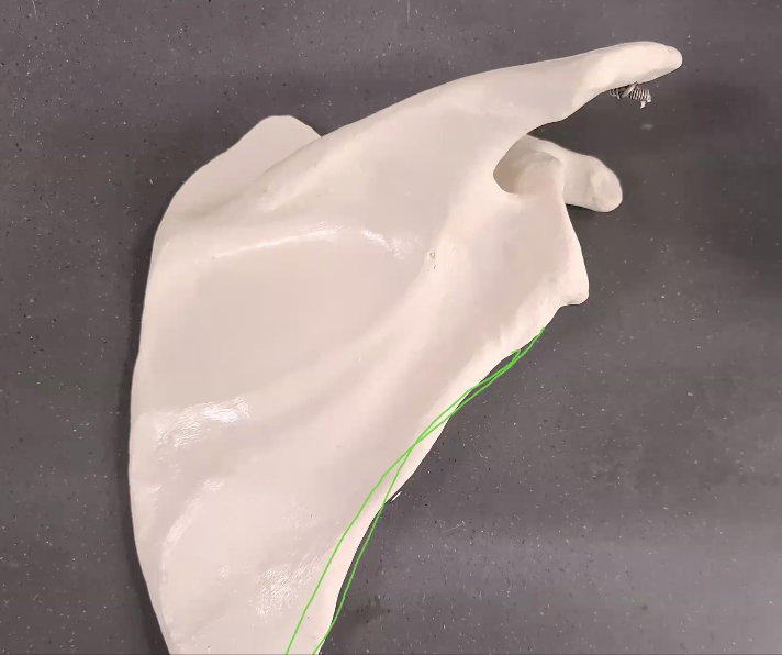<p>which side scapula?</p>