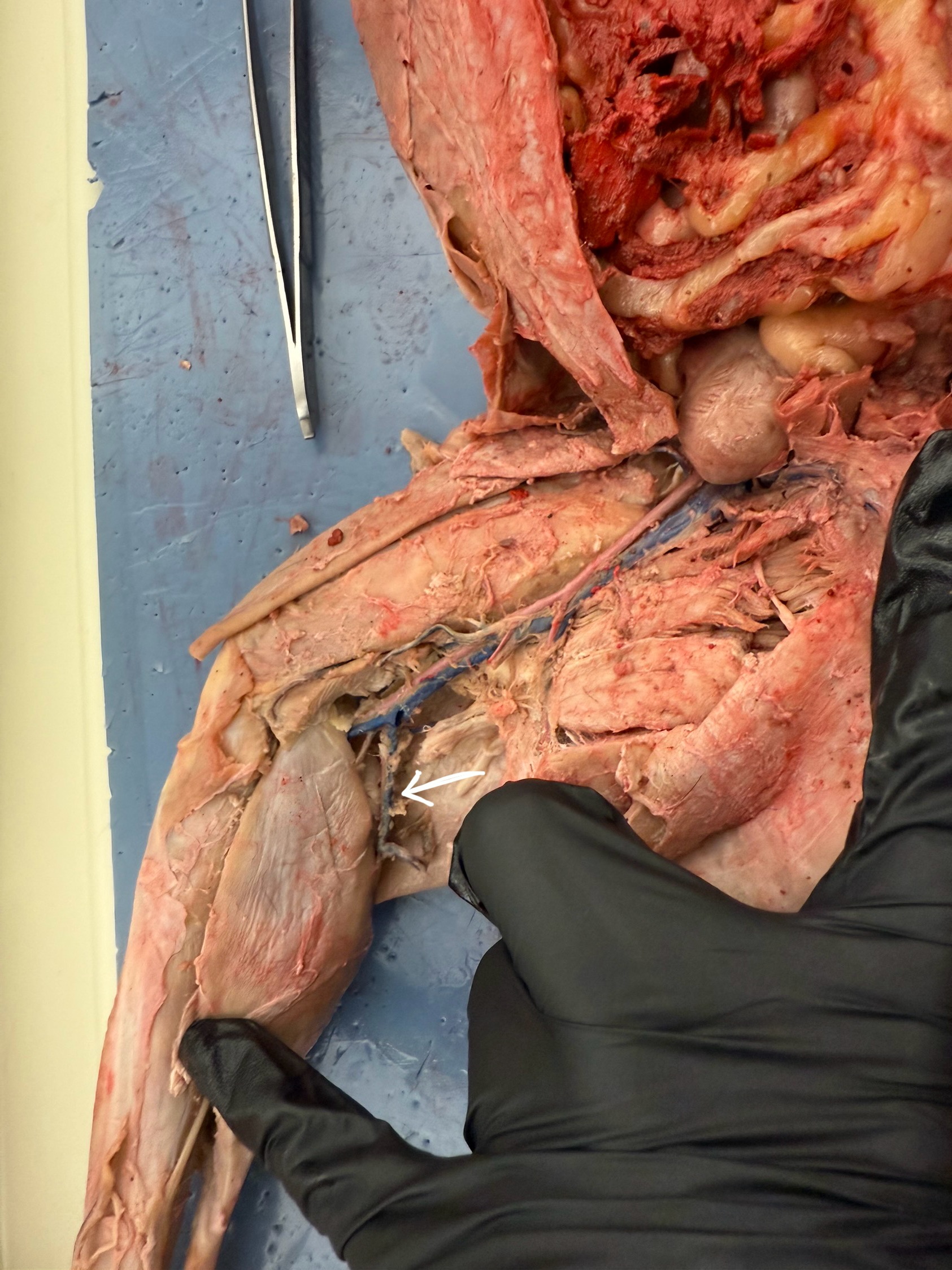 <p>What is the pointer at?</p>