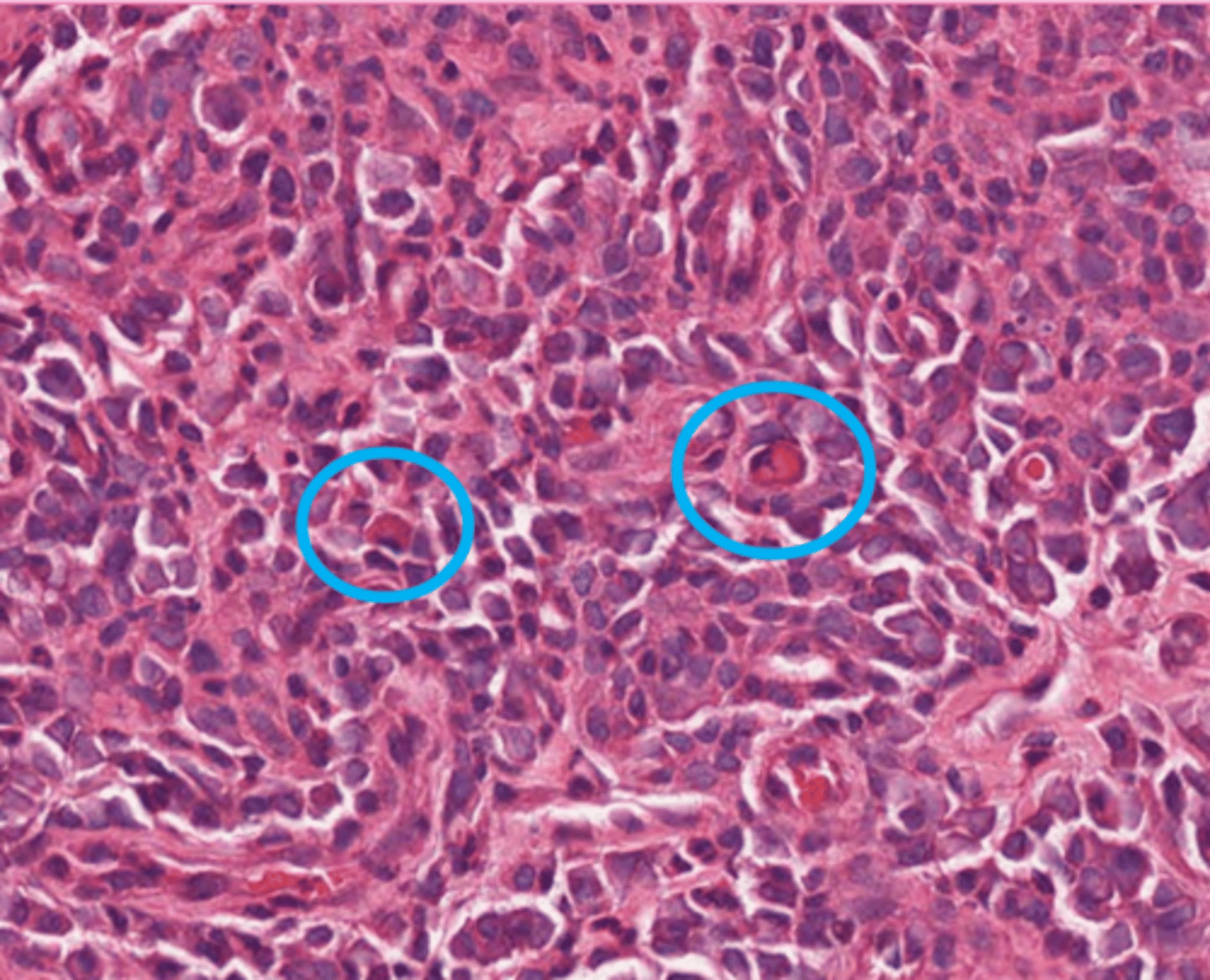 <p>These are plasma cells. what is circled?</p>