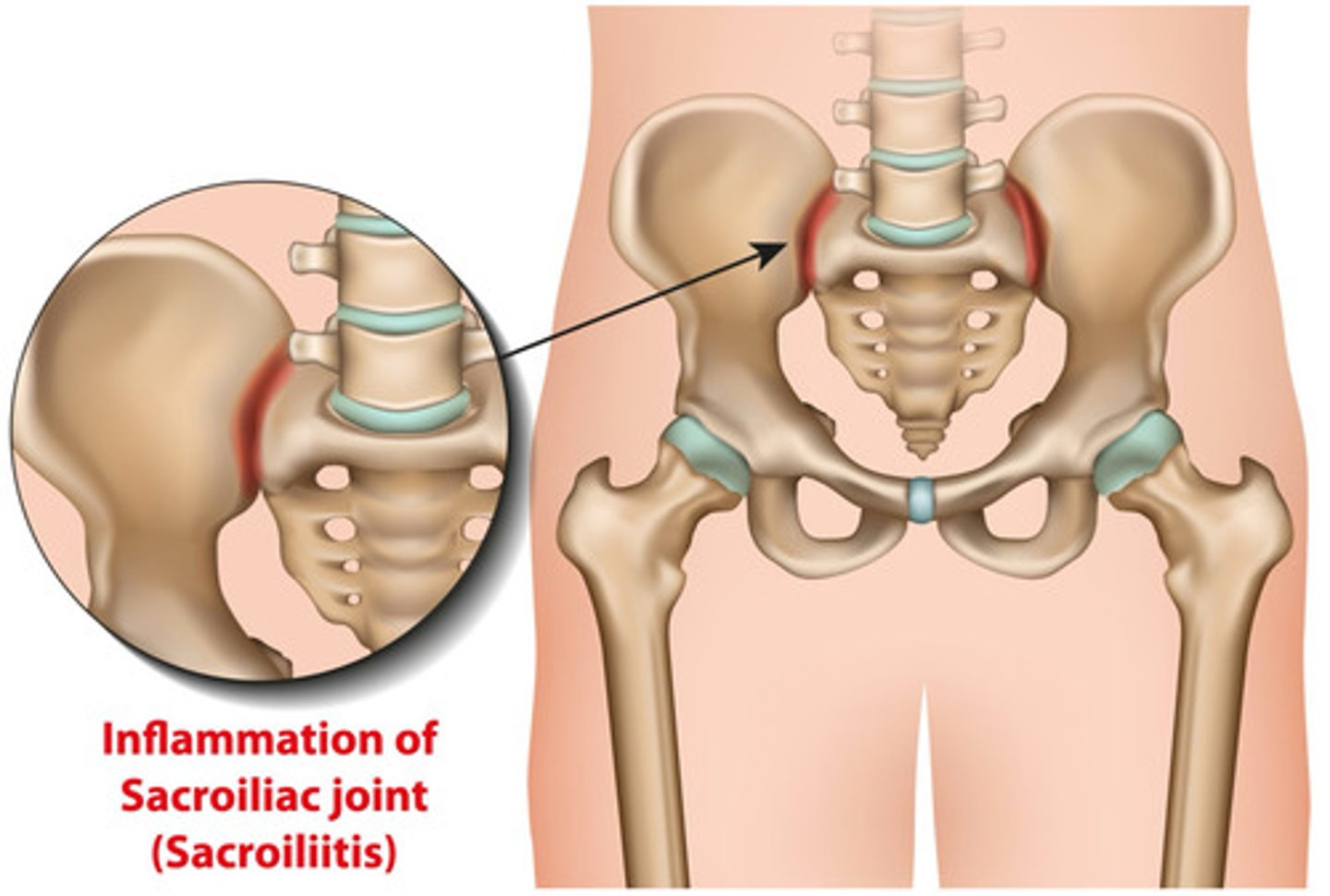 <p>weight bearing</p><p>interlocking</p><p>synovial joint</p><p>articulation between sacrum and pelvis</p>