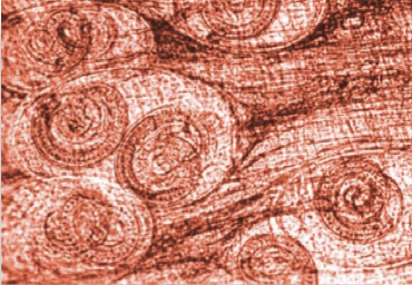 <p>only roundworm disease transmitted by eating undercooked or raw meat </p><p>- pig or bear</p><p>-consumption of cysts</p>