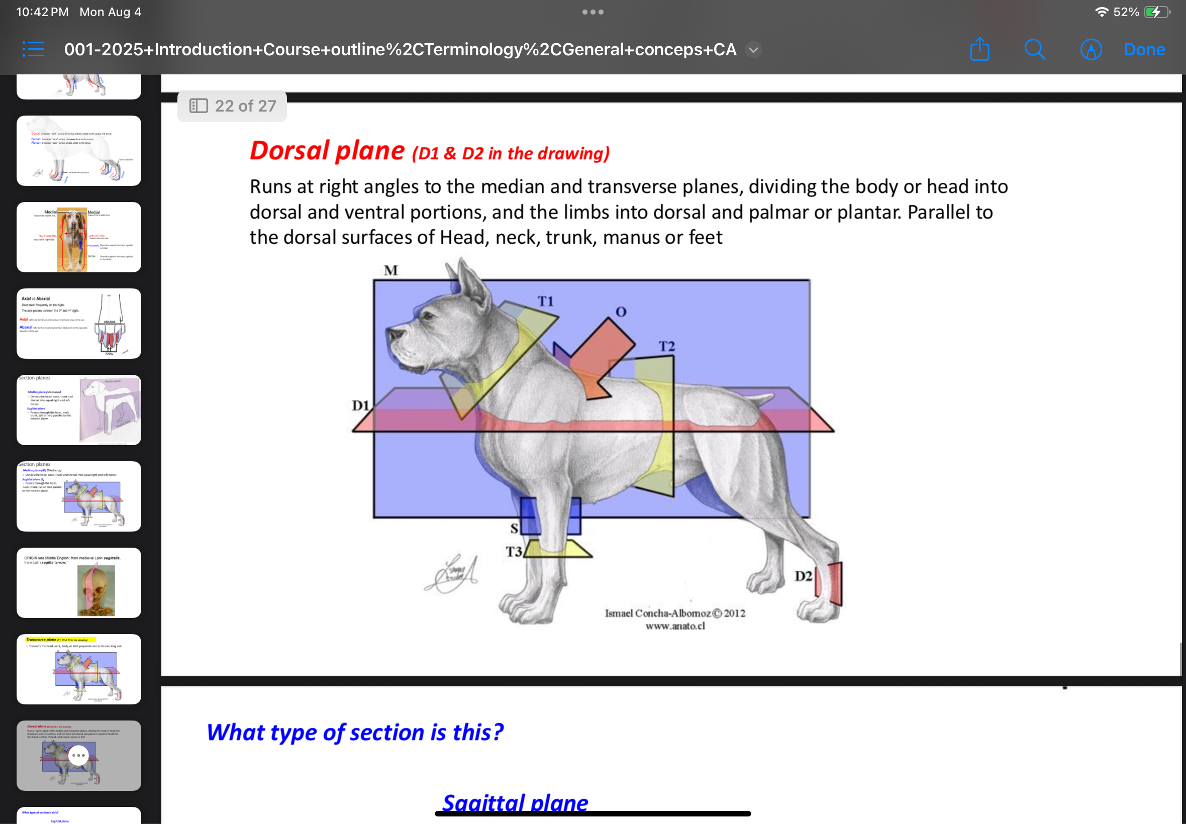 <p>Plane parallel to dorsal surfaces that divides the body into dorsal and ventral parts or limbs into dorsal and palmar/plantar parts.</p>