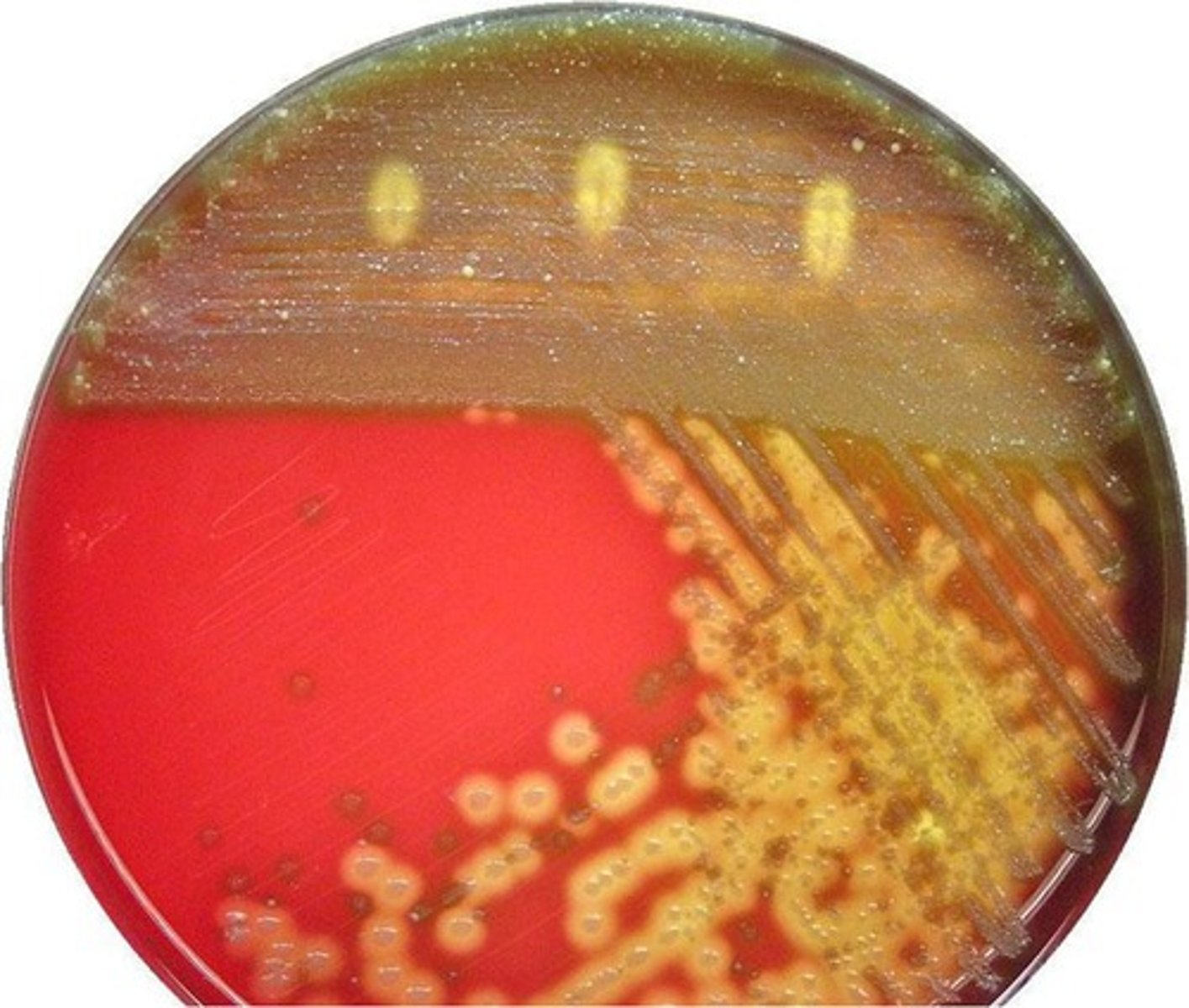 <p>microorganism that is used in clean-up of oil spills</p>