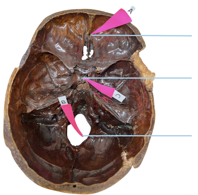 <p>Identify the foramen of the skull labelled as B.</p>