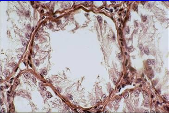 <p>Identify the structure:</p><p>Specie:</p>