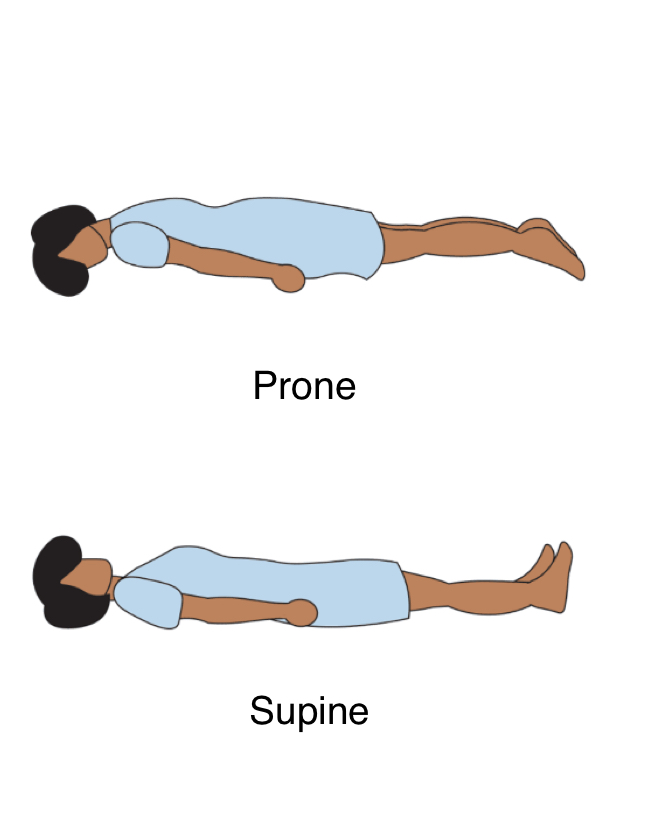 <p>Will most likely see in nursing, patient laying on their  bad on their back </p>