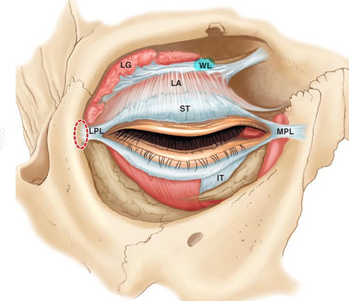 large CT band that connects to upper medial portion behind the orbital rim, and then runs right along the levator all the way  across to lacrimal gland