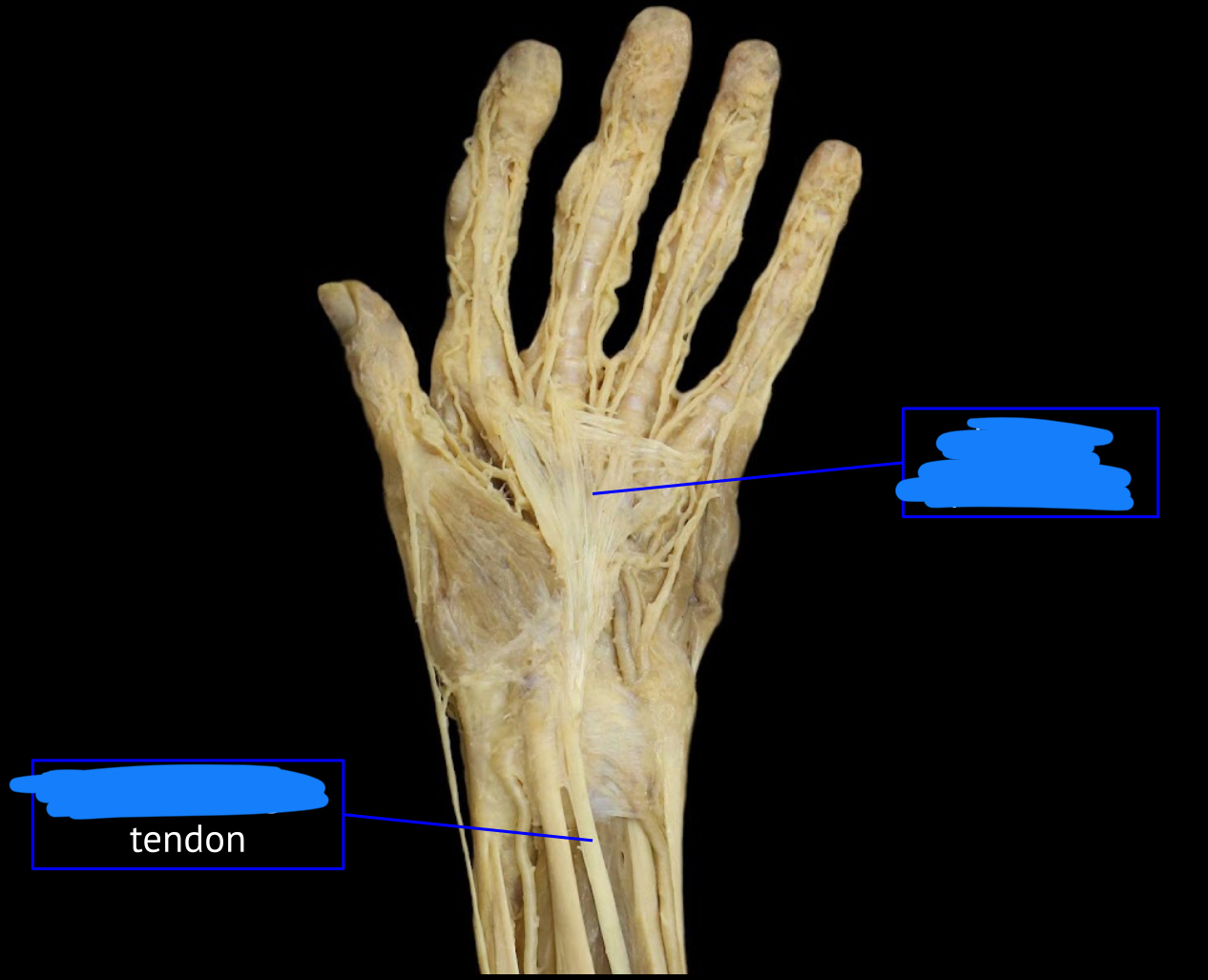 <p>name the muscle</p>