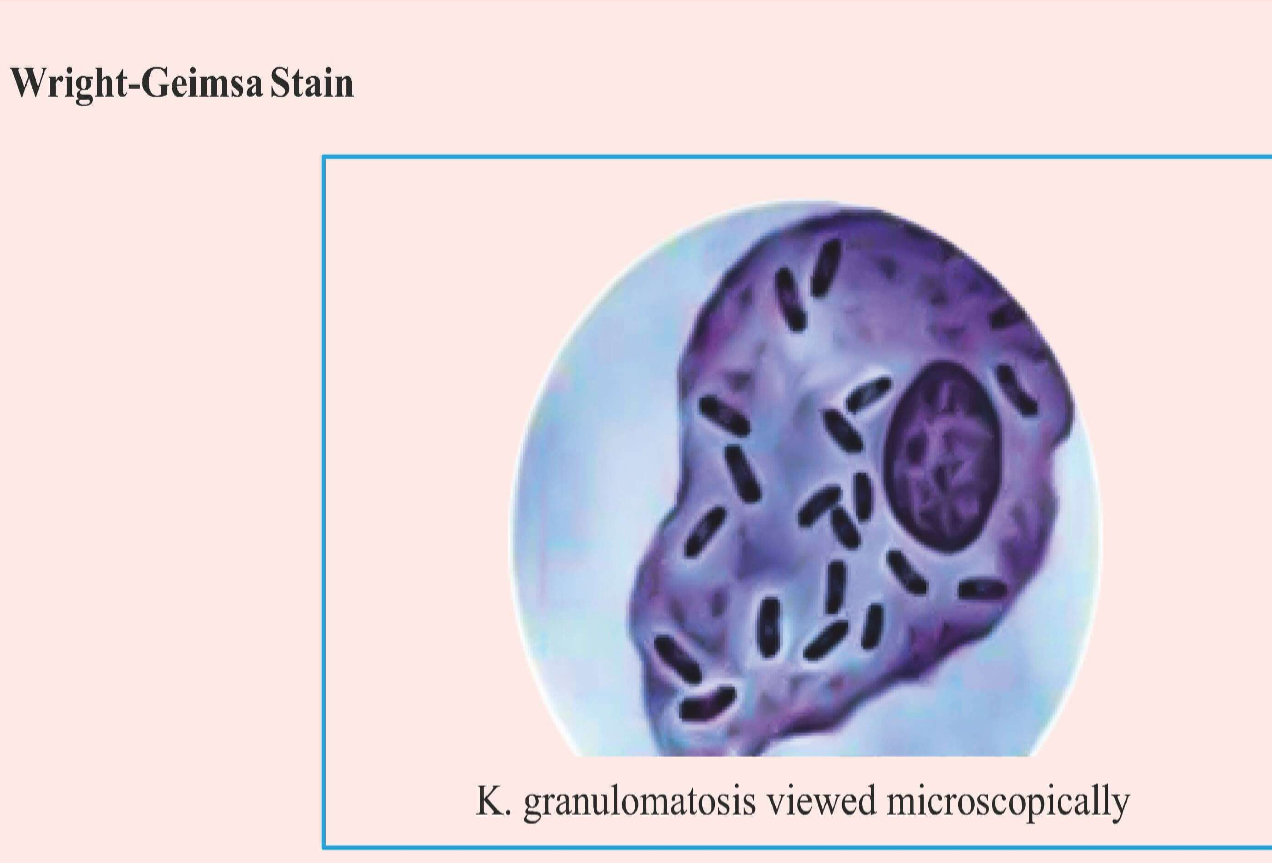 <p>Donovan bodies - Pund cells (Mononuclear cells).</p><ul><li><p>• Safety pin appearance of Donovanosis.</p></li><li><p>• Bipolar staining</p></li></ul><p></p>