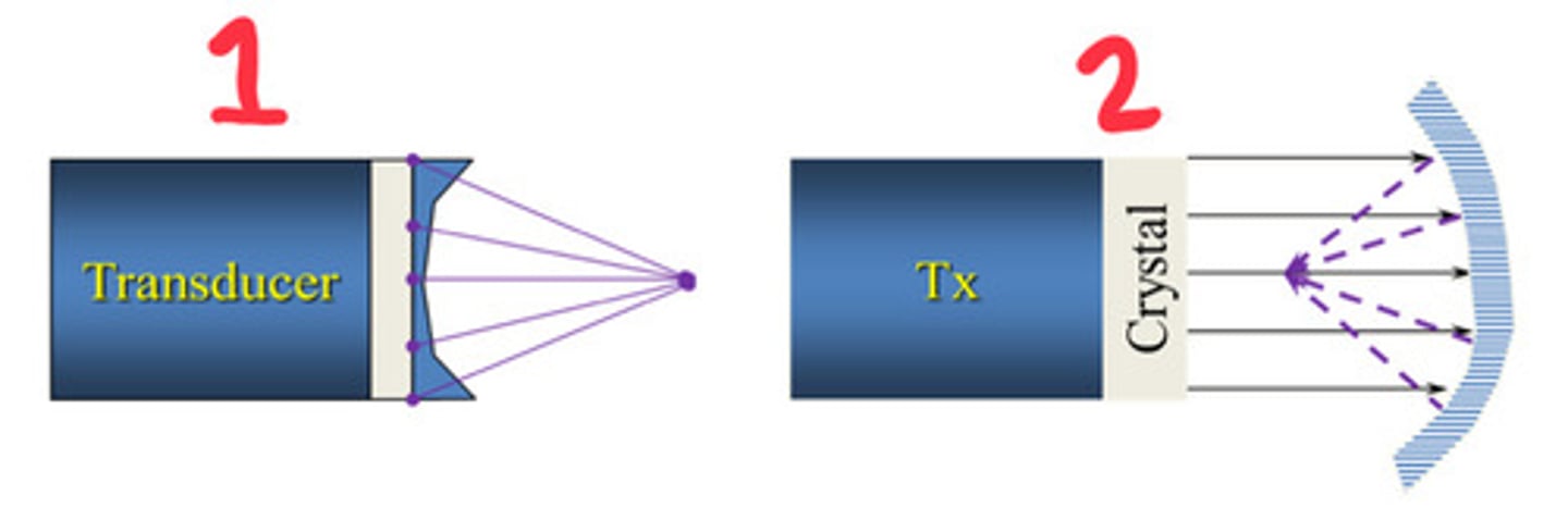 <p>What kind of external focusing is 1</p>