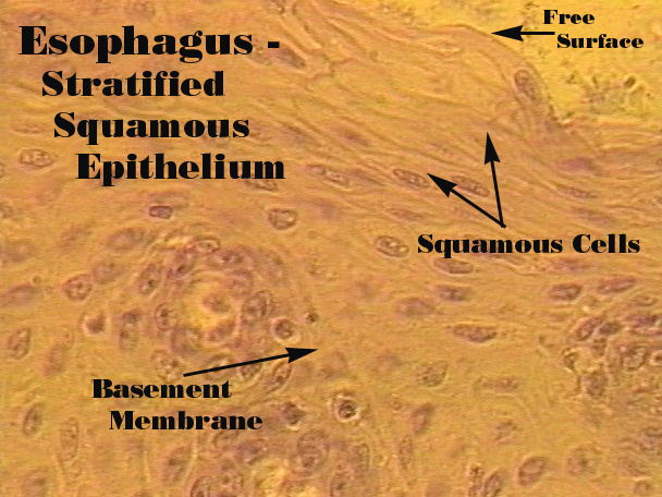 <p>Stratified Squamous</p>