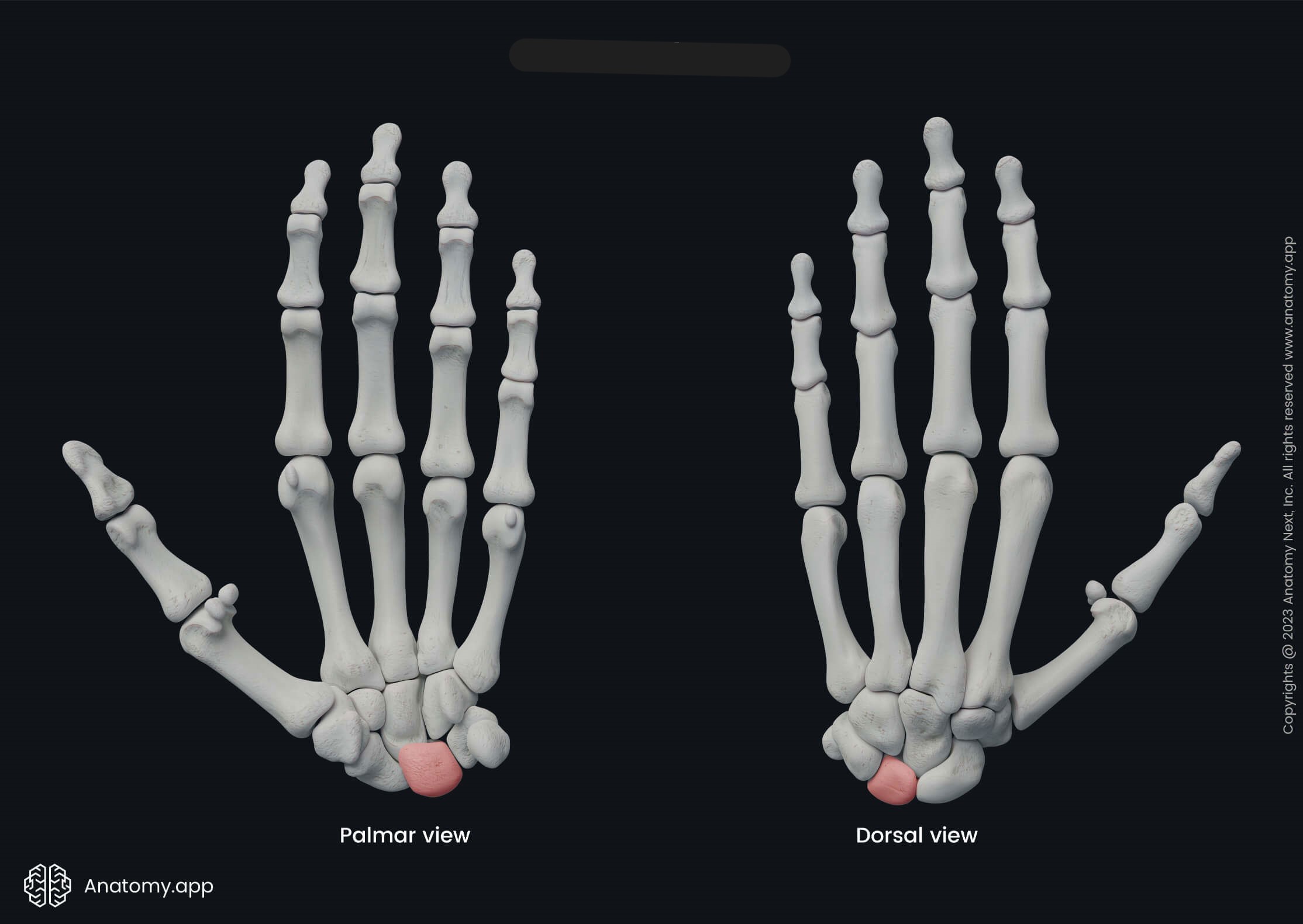 <p>What bone is this?</p>