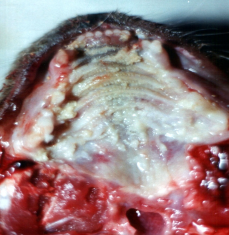 <p>Pseudomembranous stomatitis = oral mucosal inflammation characterized by the presence of white or yellowish pseudomembranes on the oral surfaces</p>